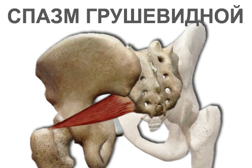спазм или ослабление грушевидной мышцы - массаж и остеобаллансировка в Геленджике в ТиП и ТаБ